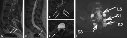 Fig 4.