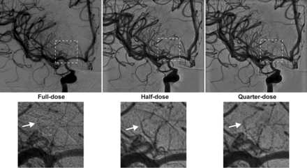 Fig 3.