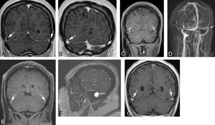 Fig 1.