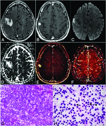 Fig 3.