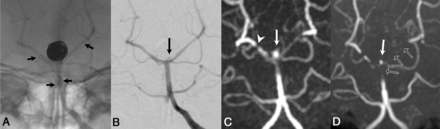 Fig 1.
