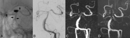 Fig 2.