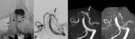 Fig 3.