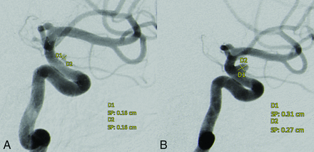 Fig 2.