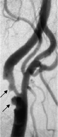 Fig 2.