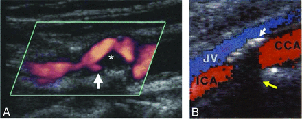 Fig 3.