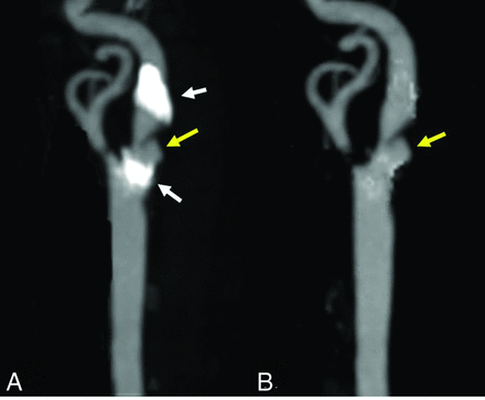Fig 5.