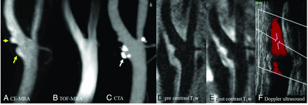 Fig 7.