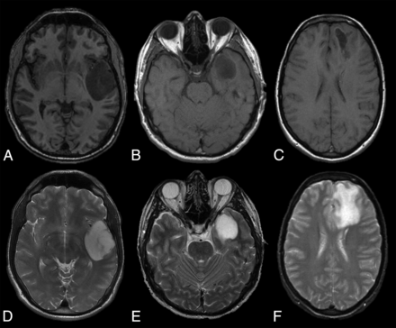 Fig 1.