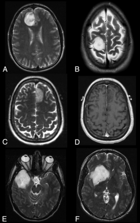 Fig 2.