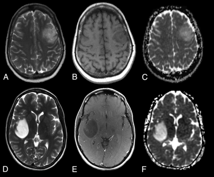 Fig 3.