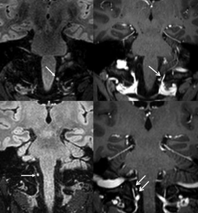Fig 4.