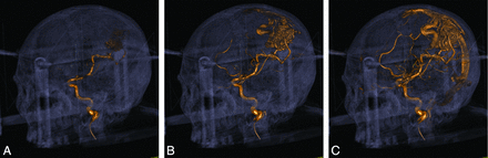 Fig 2.