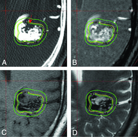 Fig 3.