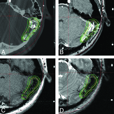 Fig 4.