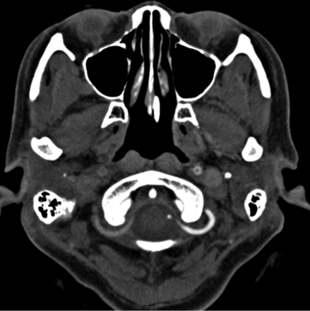 Fig 3.