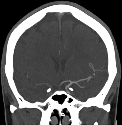Fig 4.