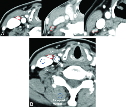 Fig 2.