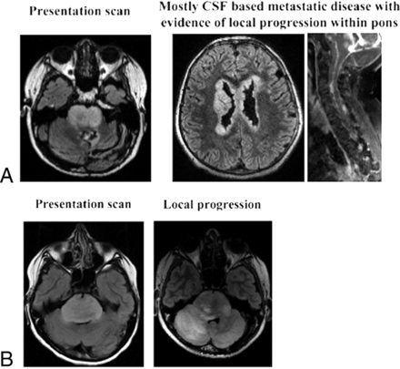 Fig 3.