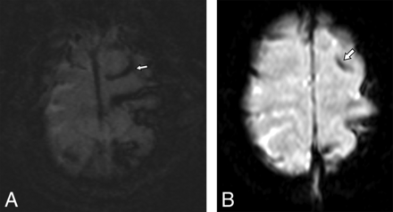 Fig 2.
