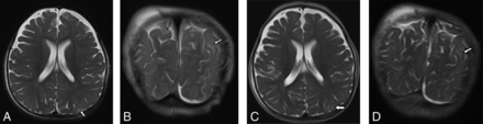 Fig 3.