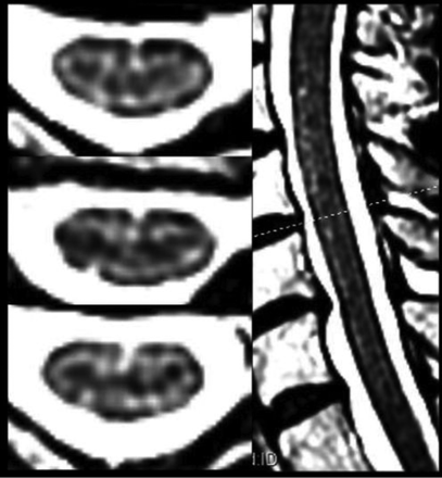 Fig 1.