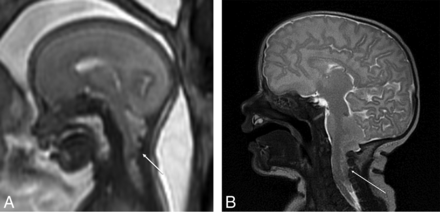 Fig 2.