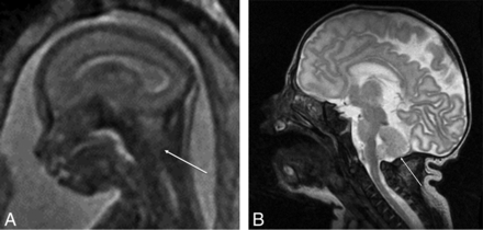 Fig 4.