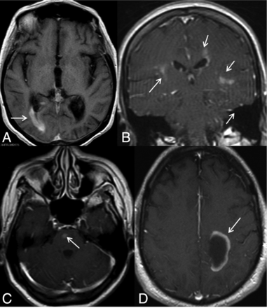 Fig 1.