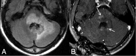 Fig 2.