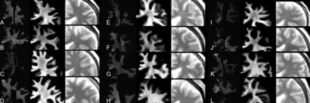 Fig 3.