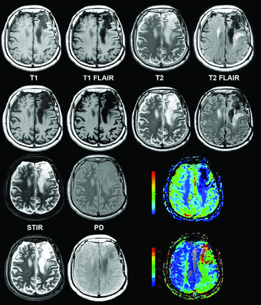 Fig 5.