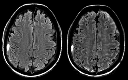 Fig 6.