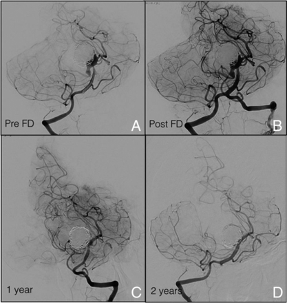 Fig 2.