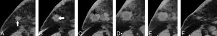 Fig 3.