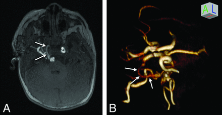 Fig 2.