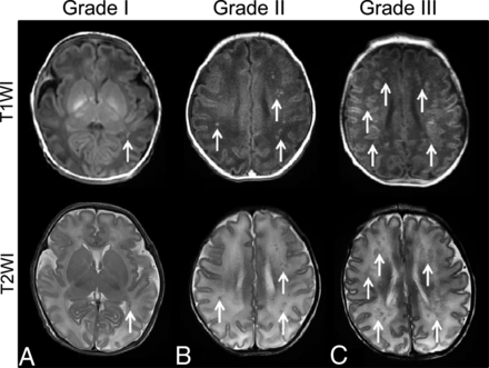 Fig 1.