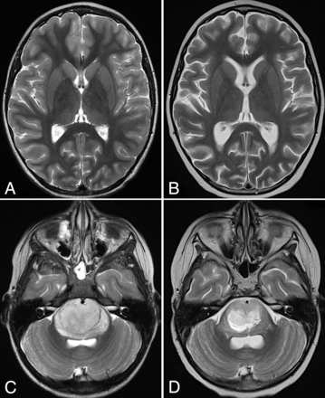 Fig 1.