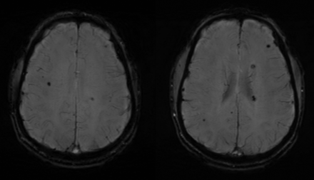 Fig 3.