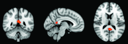 Fig 1.