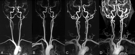 Fig 2.