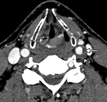 Fig 2.