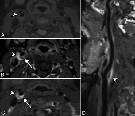 Fig 4.