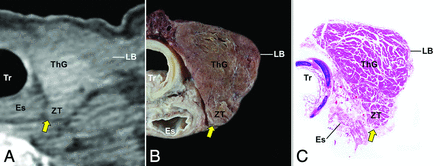 Fig 3.