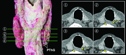 Fig 4.