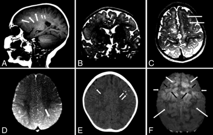 Fig 4.