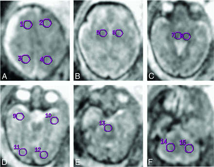 Fig 1.