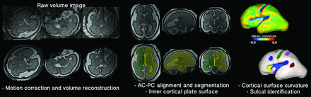 Fig 1.