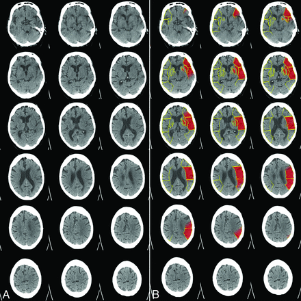 Fig 3.