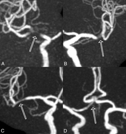 Fig 1.